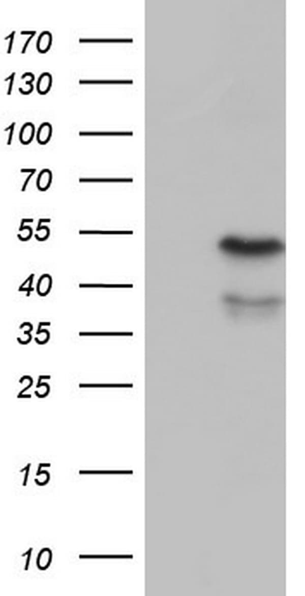 CD39 Antibody (aa38-307, clone OTI2A1)