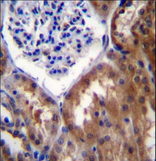 PPP1R15B Antibody (aa494-522)