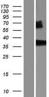 Human NIT1 Protein (Over-Expression Lysate Myc-DDK (Flag))