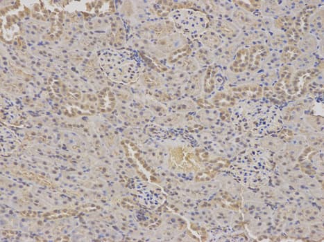 Polyclonal Rabbit anti-Human GABRA2 Antibody (IHC, WB)