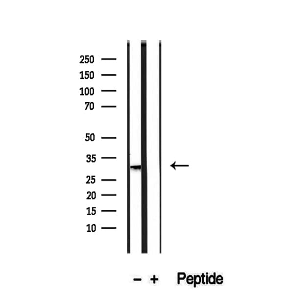 PMM2 Antibody