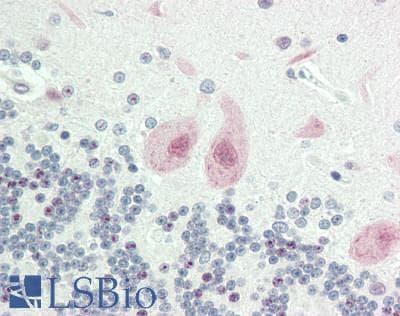 IHC-plus™ Polyclonal Rabbit anti-Human PRMT1 Antibody (aa1-50, IHC, WB)