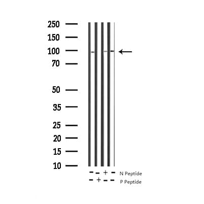 PRKCD / PKC-Delta Antibody (phospho-Tyr64)