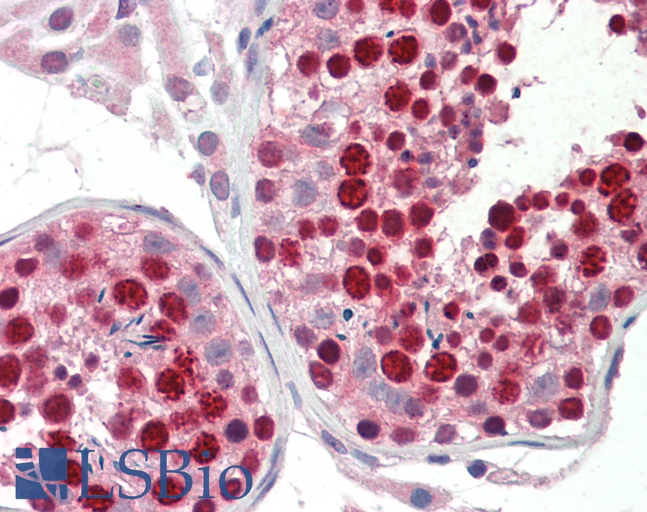 IHC-plus™ Polyclonal Goat anti-Human ABCA9 Antibody (aa599-612, IHC, WB)