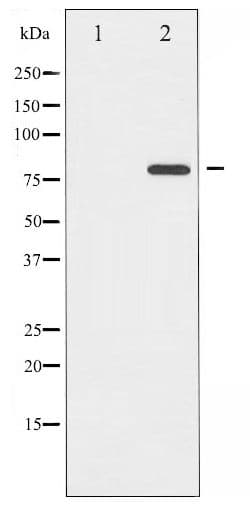 Polyclonal Rabbit anti-Human MAPT / Tau Antibody (phospho-Ser422, IHC, WB)