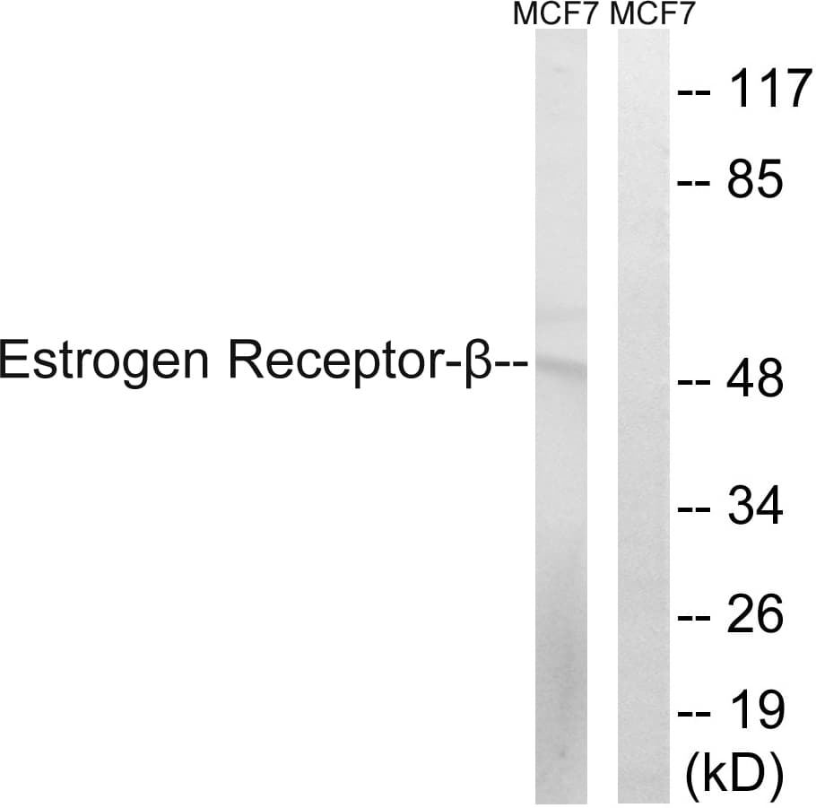 ESR2 / ER Beta Antibody