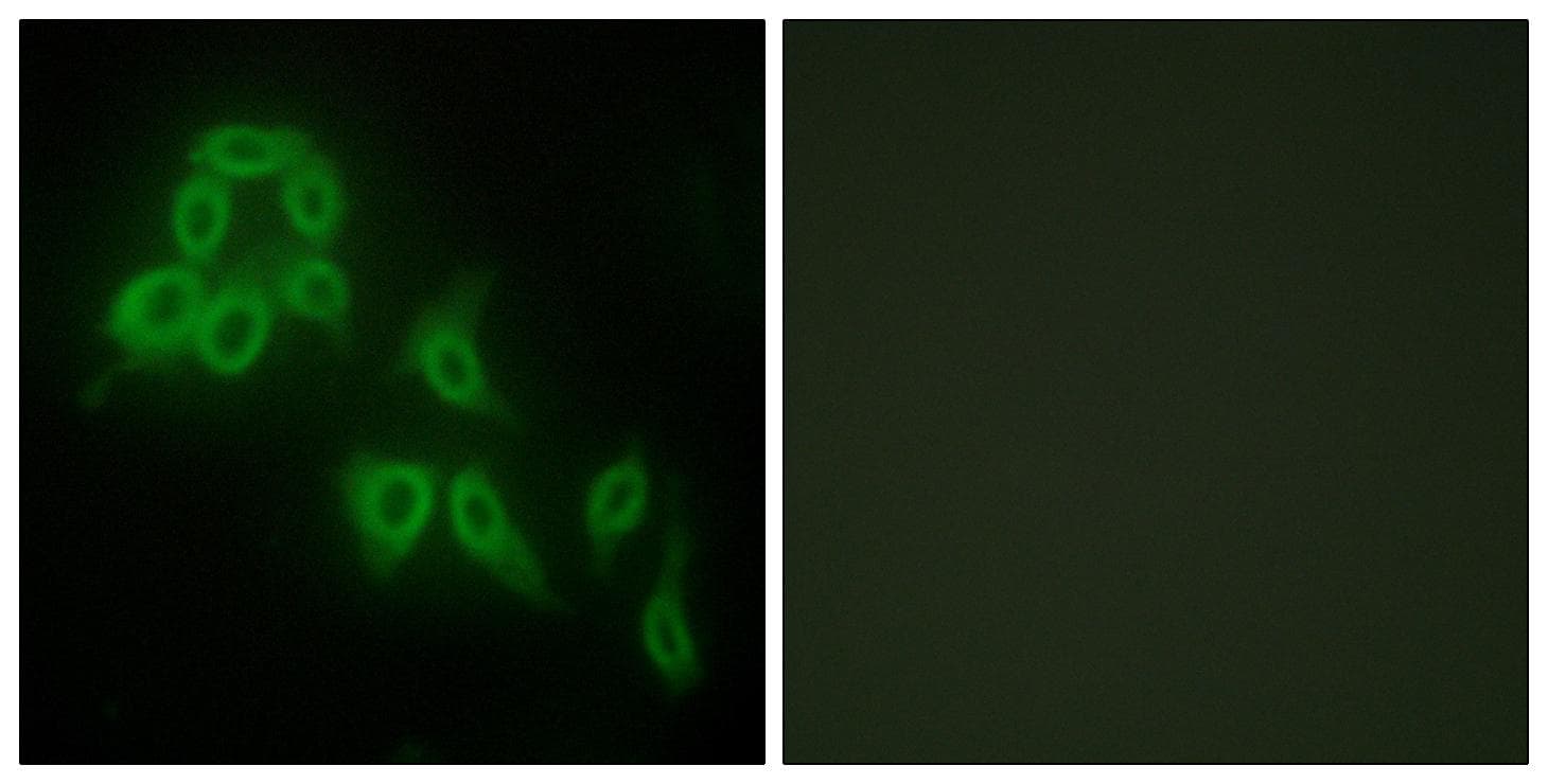COL5A2 / Collagen V Alpha 2 Antibody