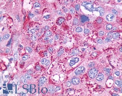 PathPlus™ Polyclonal Rabbit anti-Human CCKBR / Cckb Antibody (Cytoplasmic Domain, IHC)