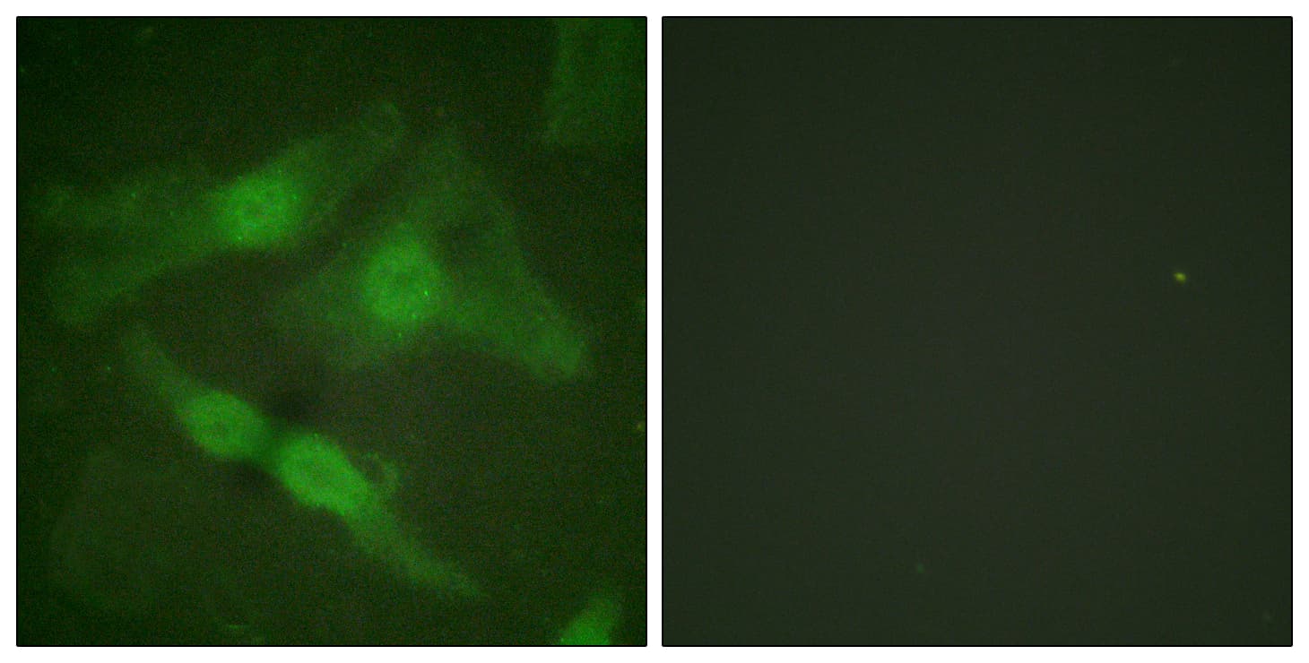 PRKCZ / PKC-Zeta Antibody (phospho-Thr410)