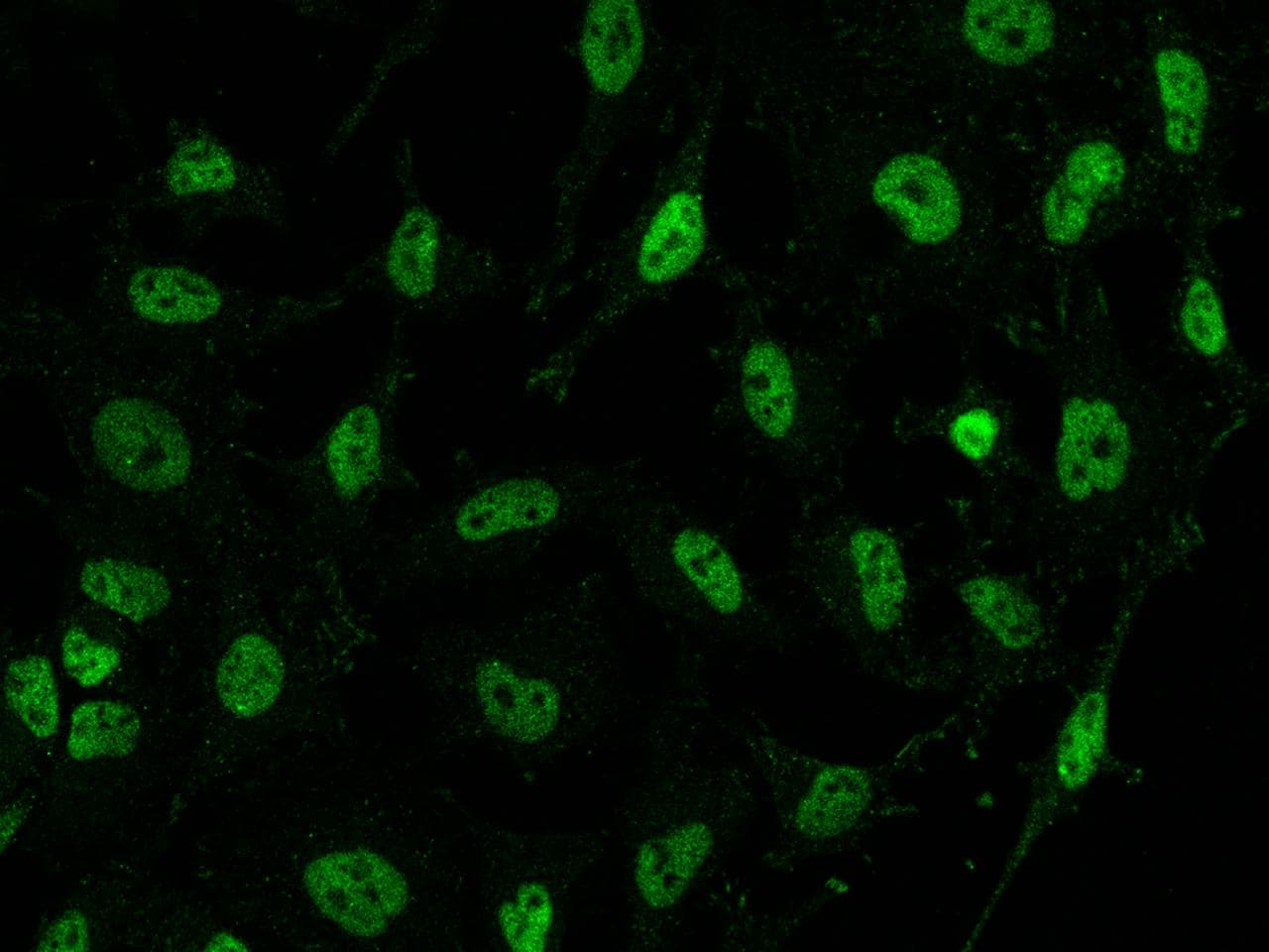 Polyclonal Rabbit anti-Human SS18 Antibody (IF)