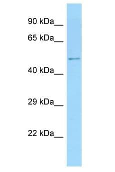 ZNF384 Antibody (aa39-88)