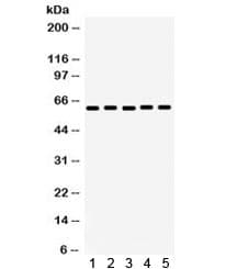 MAOA / Monoamine Oxidase Antibody