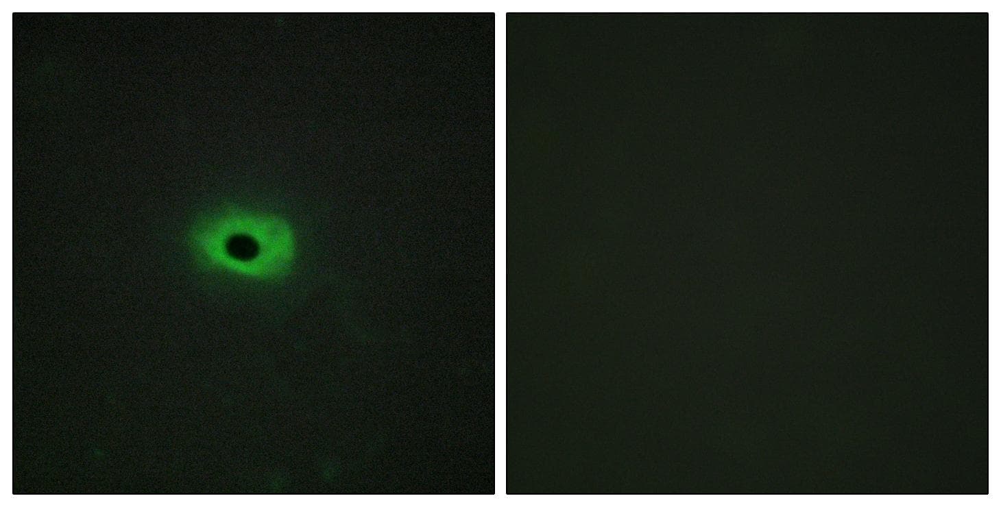 SDC4 / Syndecan 4 Antibody (p179)