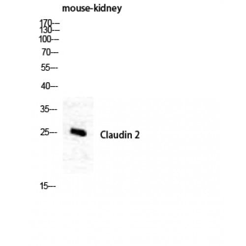 Polyclonal Rabbit anti-Human CLDN2 / Claudin 2 Antibody (150-230 aa, C-terminal, IHC, WB)