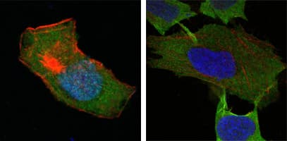 IHC-plus™ Monoclonal Mouse anti-Human GSTP1 / GST Pi Antibody (clone 3F2C2, IHC, IF, WB)