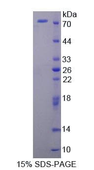 Human FKBP4 / FKBP52 Protein (Recombinant His-GST)