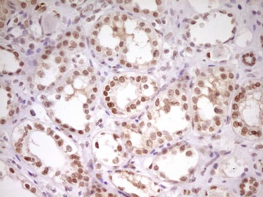 HMG20A Antibody (aa1-281, clone OTI5E4)