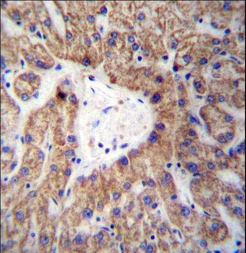 GLYAT Antibody (aa171-199)