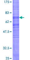 Human NMUR2 Protein (Recombinant GST)