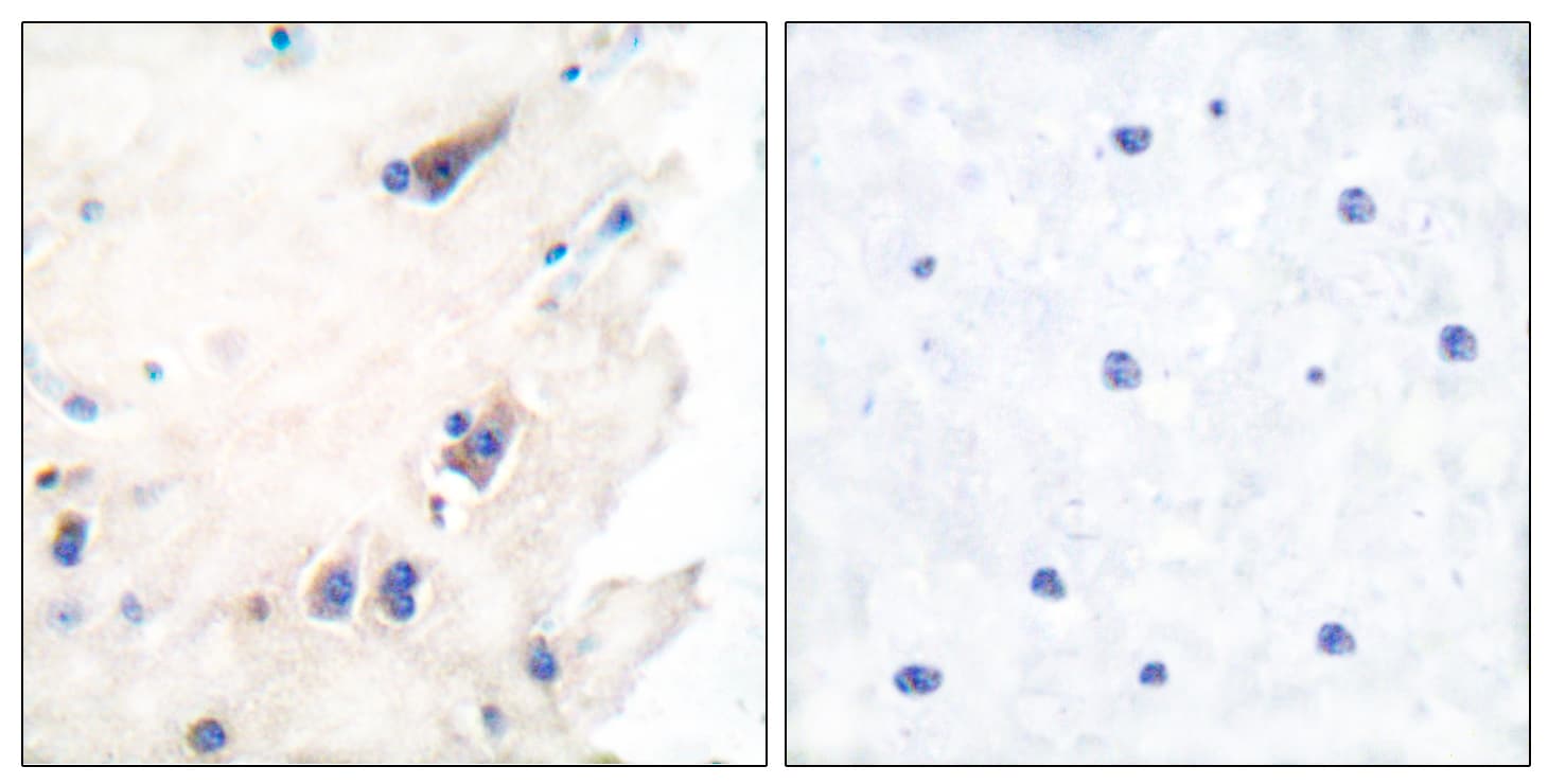 PLCB3 Antibody (aa1071-1120)