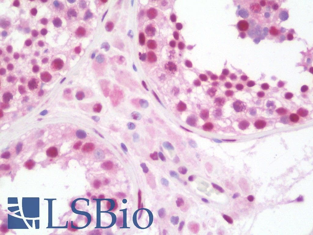 IHC-plus™ STAT5A Antibody (clone 9F7)