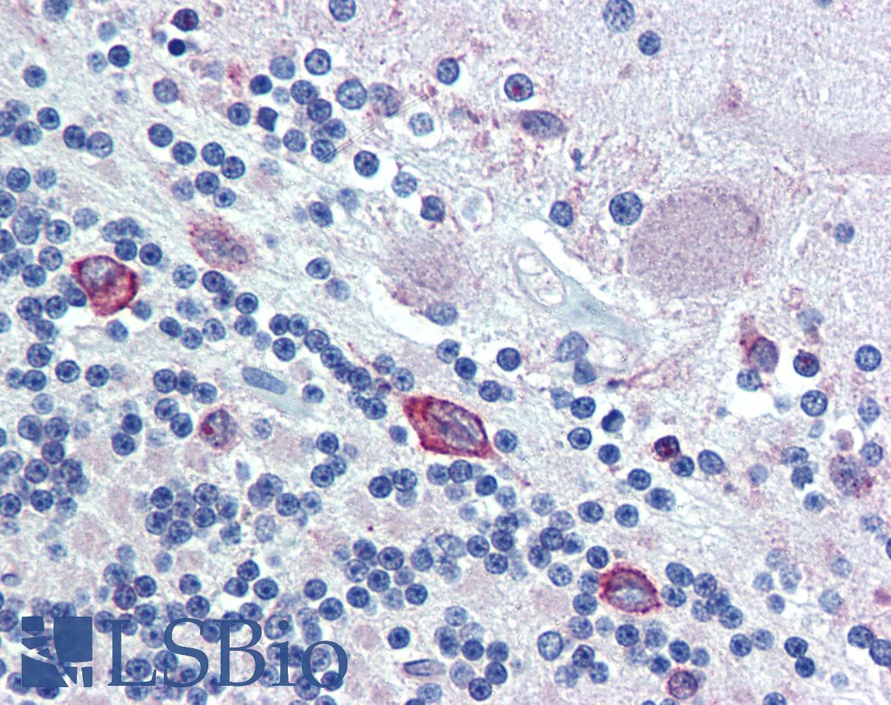 IHC-plus™ PDIA4 / ERP72 Antibody (aa623-638)