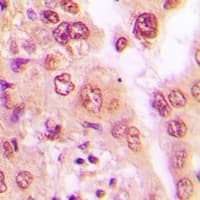 Polyclonal Rabbit anti-Human PSMA6 Antibody (IHC, IF, WB)