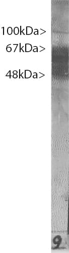 Polyclonal Chicken anti-Human MAPT / Tau Antibody (IF, WB)