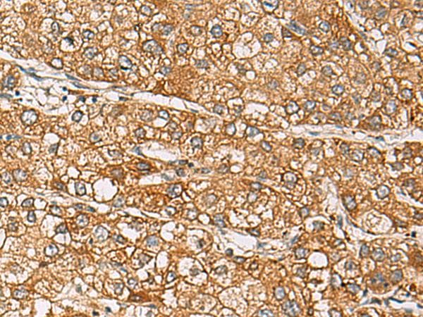 DCAF12 / WDR40A Antibody