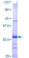 Human SLC6A3 / Dopamine Transporter Protein (Recombinant GST, N-terminus)