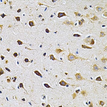 ADRBK1 / GRK2 Antibody