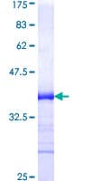 Human ALK3 / BMPR1A Protein (Recombinant GST, N-terminus)