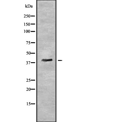 Polyclonal Rabbit anti-Human PYGO2 / Pygopus 2 Antibody (WB)
