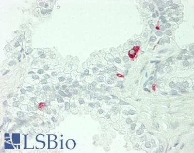 IHC-plus™ GPRC6A Antibody