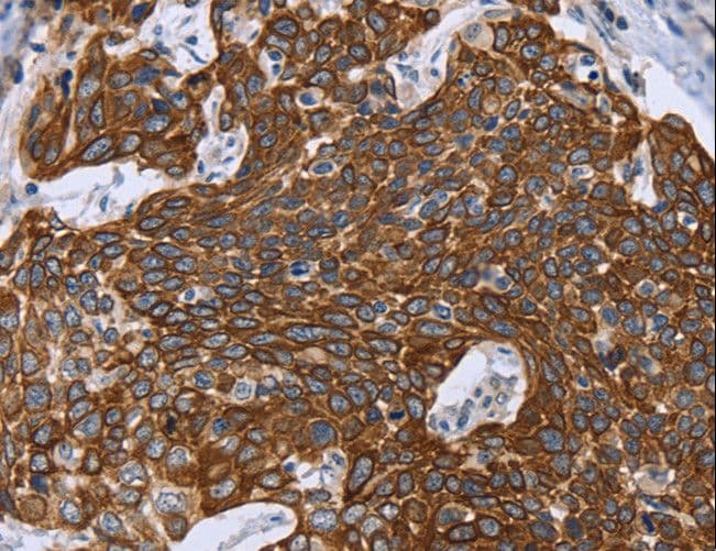 Polyclonal Rabbit anti-Human GRPR Antibody (aa322-365, IHC, WB)