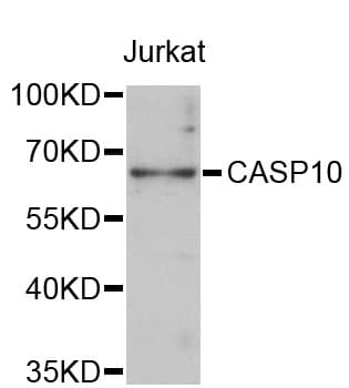 PathPlus™ CASP10 / Caspase 10 Antibody