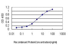 POMC / Proopiomelanocortin Antibody (clone 3E11)