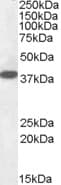 IHC-plus™ EPM2A / Laforin Antibody (aa131-144)