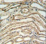 Polyclonal Rabbit anti-Human ADH7 Antibody (aa318-346, IHC, IF, WB)