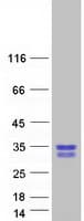 Human GAR1 / NOLA1 Protein (Recombinant Myc-DDK (Flag))