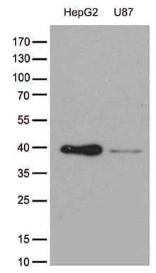 GALM / Mutarotase Antibody (clone OTI10B3)