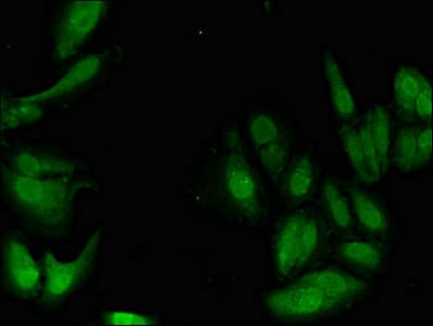 PIM1 / Pim-1 Antibody