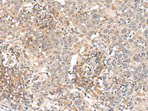 SLC40A1 / Ferroportin-1 Antibody