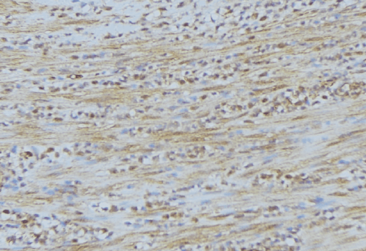 NEURL2 Antibody