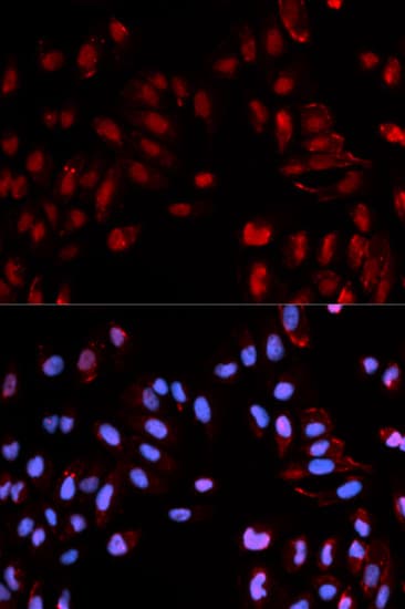 Polyclonal Rabbit anti-Human HIST1H3B Antibody (phospho-Ser29, IF, WB)