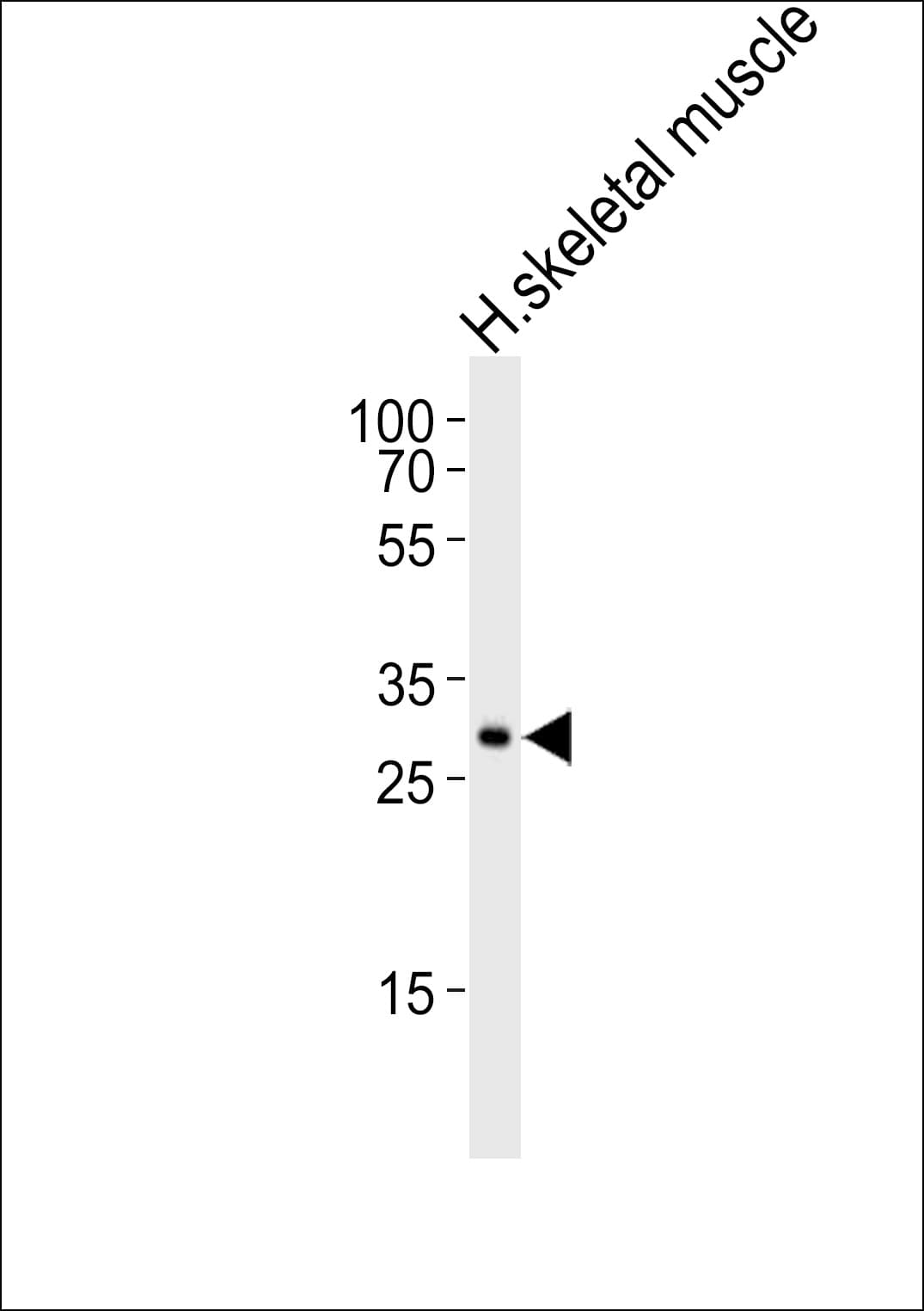 Polyclonal Rabbit anti-Human GBAS Antibody (aa176-210, WB)