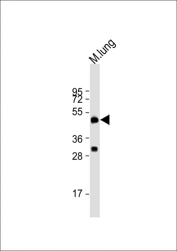 Dipeptidase 2 / DPEP2 Antibody (aa220-254)