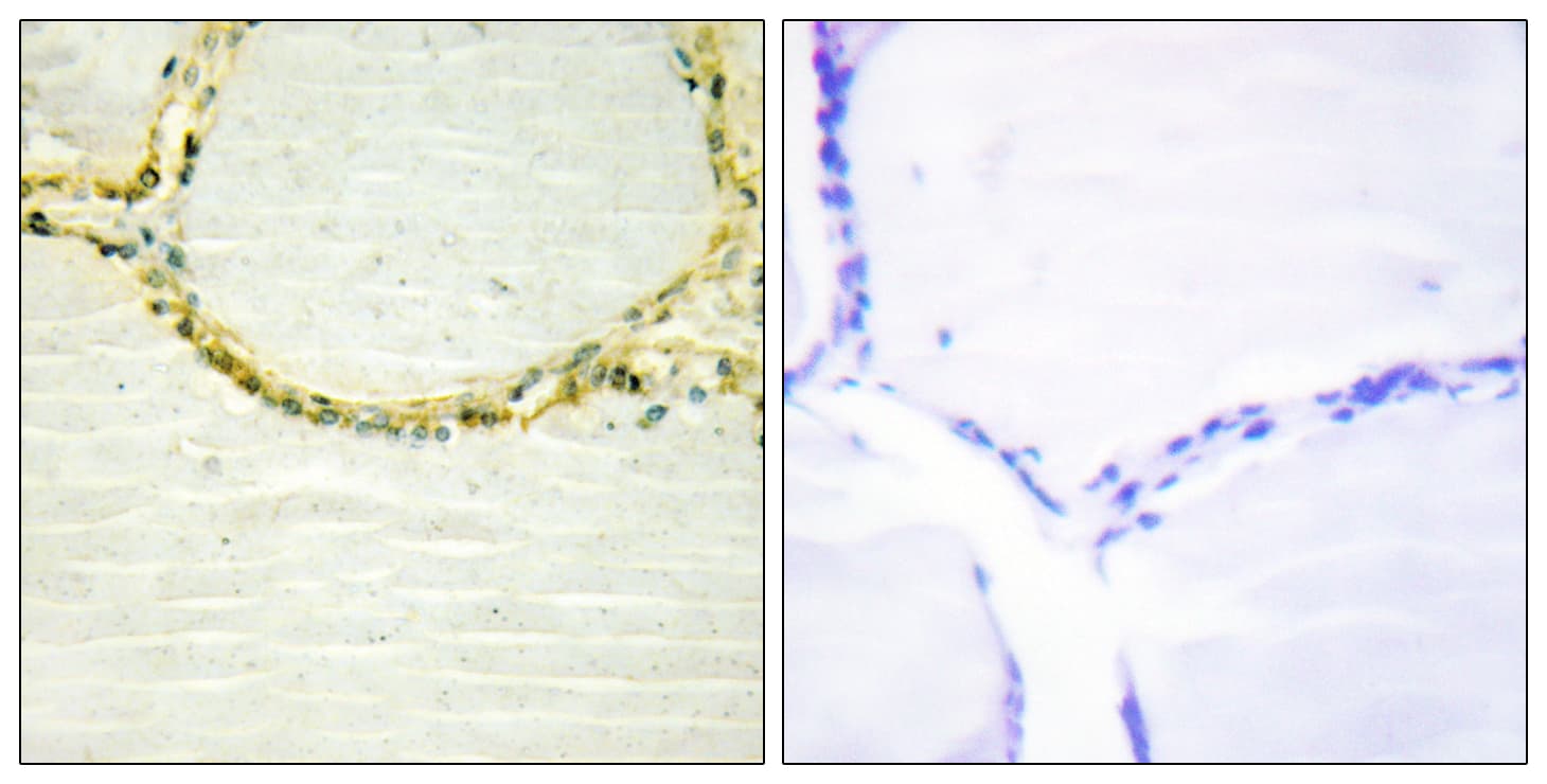 Polyclonal Rabbit anti-Human ETK / BMX Antibody (phospho-Tyr566, IHC, WB)