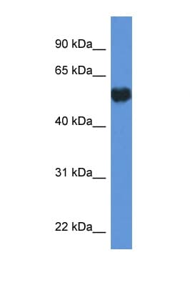 Polyclonal Rabbit anti-Human GPI Antibody (C-Terminus, WB)