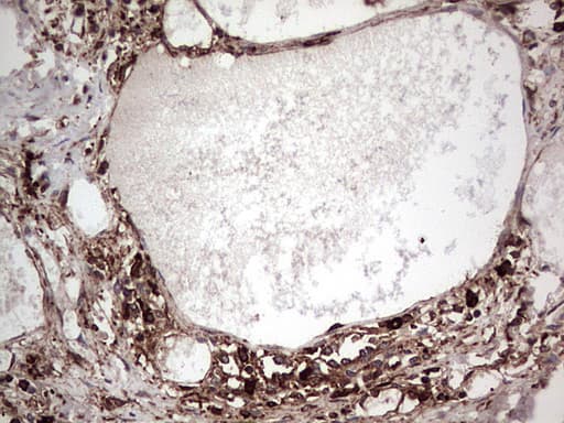 PKM2 Antibody (clone 1G10)